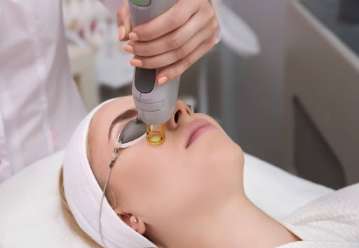 une therapeute qui effectue une epilation laser sur le visage d'une femme